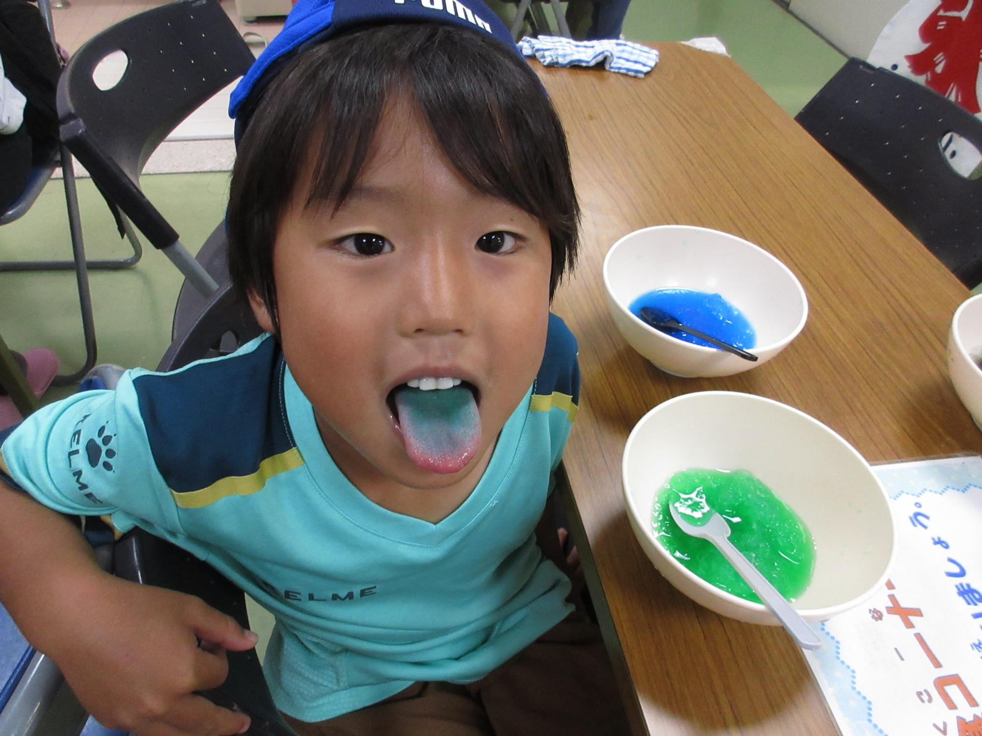 舌の色が変わっている小学生の写真